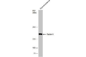 WB Image Human tissue extract (30 μg) was separated by 5% SDS-PAGE, and the membrane was blotted with Factor H antibody [N3C1], Internal , diluted at 1:500. (Complement Factor H Antikörper)