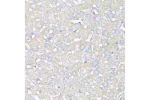 Immunohistochemistry (Paraffin-embedded Sections) (IHC (p)) image for anti-ATG5 Autophagy Related 5 (ATG5) (AA 1-275) antibody (ABIN3020674)