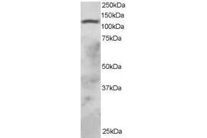 Image no. 1 for anti-Ring Finger Protein 31 (RNF31) (AA 908-921) antibody (ABIN297591)