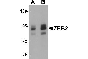 Western Blotting (WB) image for anti-Zinc Finger E-Box Binding Homeobox 2 (ZEB2) (C-Term) antibody (ABIN1030819) (ZEB2 Antikörper  (C-Term))