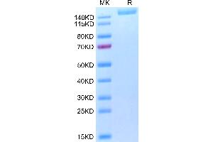 Biotinylated SARS-COV-2 Spike S(B.