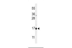 Western blot analysis of DAZ Antibody (C-term) (ABIN653931 and ABIN2843163) in  cell line lysates (35 μg/lane).