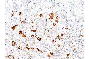 Formalin-fixed, paraffin-embedded human Pituitary stained with TSH beta Mouse Monoclonal Antibody (TSHb/1317).