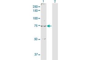 Western Blotting (WB) image for anti-Nuclear Receptor Subfamily 4, Group A, Member 2 (NR4A2) (AA 1-598) antibody (ABIN518472)