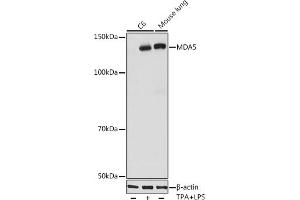 Western blot analysis of extracts of various cell lines, using MD antibody (ABIN7267950) at 1:1000 dilution. (IFIH1 Antikörper)