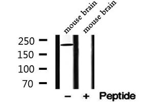 Western blot analysis of extracts from mouse brain, using DENND4A Antibody. (DENND4A Antikörper  (Internal Region))