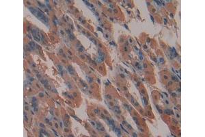 IHC-P analysis of stomach tissue, with DAB staining. (ABCA9 Antikörper  (AA 1422-1589))