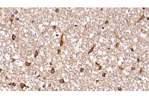 Immunohistochemistry (IHC) image for anti-Guanine Nucleotide Binding Protein (G Protein), beta Polypeptide 1-Like (GNB1L) (AA 69-247) antibody (ABIN7439600)