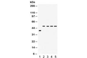 Western blot testing of 1) rat intestine and human 2) SW620, 3) COLO320, 4) HeLa and 5) A549 lysate with IRF2 antibody.