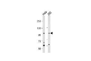 All lanes : Anti-hNEK4- at 1:2000 dilution Lane 1: Hela whole cell lysate Lane 2: 293 whole cell lysate Lysates/proteins at 20 μg per lane.