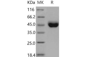 Western Blotting (WB) image for CD5 (CD5) (AA 1-371) protein (His tag) (ABIN7320289) (CD5 Protein (CD5) (AA 1-371) (His tag))