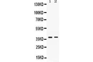 Western blot analysis of TNFRSF14/HVEM expression in HELA whole cell lysates ( Lane 1) and SW620 whole cell lysates ( Lane 2). (HVEM Antikörper  (AA 39-202))