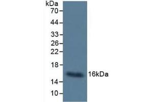 Detection of Cys-C in Human Urine using Monoclonal Antibody to Cystatin C (Cys-C) (CST3 Antikörper  (AA 27-146))