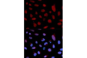Immunofluorescence analysis of U2OS cell using TNNC1 antibody.