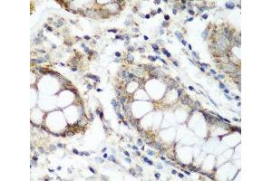 Immunohistochemistry of paraffin-embedded Human colon using NAA60 Polyclonal Antibody at dilution of 1:200 (40x lens). (NAT15 Antikörper)