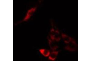 ABIN6275252 staining A549 cells by IF/ICC. (MPHOSPH9 Antikörper  (Internal Region))