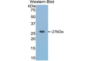 Western Blotting (WB) image for anti-Frizzled Family Receptor 1 (Fzd1) (AA 117-322) antibody (ABIN3204002) (FZD1 Antikörper  (AA 117-322))