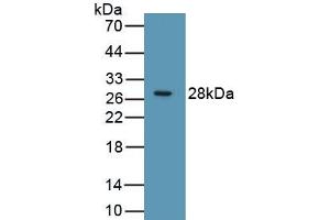 Detection of Recombinant RIPK3, Human using Polyclonal Antibody to Receptor Interacting Serine Threonine Kinase 3 (RIPK3) (RIPK3 Antikörper  (AA 1-217))