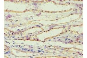 Immunohistochemistry of paraffin-embedded human kidney tissue using ABIN7143685 at dilution of 1:100 (AKR1B1 Antikörper  (AA 1-316))