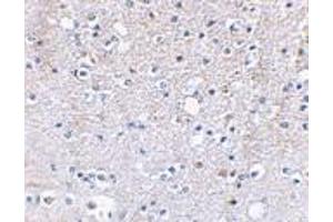 Immunohistochemical staining of human brain tissue using AP30386PU-N Grik5 antibody at 2. (GRIK5 Antikörper  (C-Term))