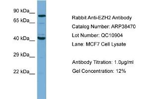WB Suggested Anti-EZH2 Antibody Titration: 1. (EZH2 Antikörper  (N-Term))