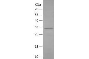 Western Blotting (WB) image for Complement Component (3d/Epstein Barr Virus) Receptor 2 (CR2) (AA 1-70) protein (His-IF2DI Tag) (ABIN7283407) (CD21 Protein (AA 1-70) (His-IF2DI Tag))