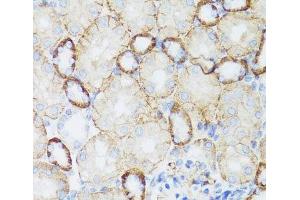 Immunohistochemistry of paraffin-embedded Mouse kidney using NEFH Polyclonal Antibody at dilution of 1:100 (40x lens). (NEFH Antikörper)