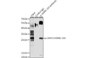 Immunoprecipitation analysis of 200 μg extracts of HeLa cells, using 3 μg Phospho-HSP27/HSPB1-S15 pAb . (HSP27 Antikörper  (pSer15))