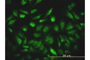 Immunofluorescence of monoclonal antibody to NCOA4 on HeLa cell. (NCOA4 Antikörper  (AA 1-575))