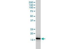 NUDT2 monoclonal antibody (M01), clone 4A4-3C3 Western Blot analysis of NUDT2 expression in Jurkat .