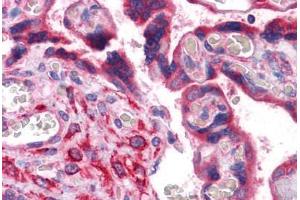 Immunohistochemistry (Formalin-fixed Paraffin-embedded Sections) (IHC (fp)) image for anti-Cysteine Rich Transmembrane BMP Regulator 1 (Chordin-Like) (CRIM1) (AA 36-146) antibody (ABIN574450)