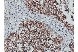 Image no. 5 for anti-CoA Synthase (COASY) antibody (ABIN1497556) (COASY Antikörper)