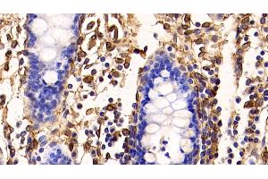 Immunohistochemistry (IHC) image for anti-Annexin A5 (ANXA5) (AA 1-321) antibody (ABIN7431455)