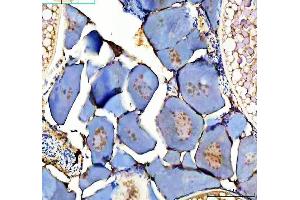 IHC analysis of Zebrafish DMRT1 using anti-Zebrafish DMRT1 antibody (AZQ71MM5).