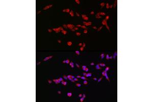 Immunofluorescence analysis of SH-SY5Y cells using GRIN2B Rabbit pAb (ABIN3017275, ABIN3017276, ABIN3017277 and ABIN1680110) at dilution of 1:100 (40x lens). (GRIN2B Antikörper  (C-Term))