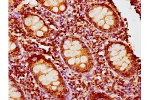 Immunohistochemistry (IHC) image for anti-Phosphoinositide-3-Kinase, Regulatory Subunit 6 (PIK3R6) (AA 566-667), (Regulatory Subunit 6) antibody (ABIN7163299)
