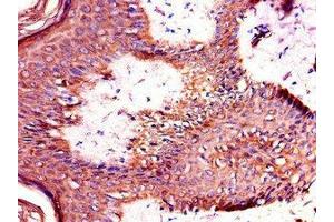 Immunohistochemistry of paraffin-embedded human skin tissue using ABIN7172328 at dilution of 1:100 (TANK Antikörper  (AA 4-98))