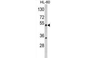 Western Blotting (WB) image for anti-Nuclear Receptor Subfamily 1, Group I, Member 2 (NR1I2) antibody (ABIN3003863)