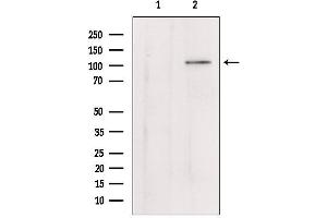 Western blot analysis of extracts from mouse lung, using Klotho Antibody. (Klotho Antikörper)