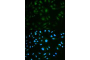 Immunofluorescence analysis of MCF7 cell using IL23R antibody.