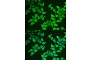 Immunofluorescence analysis of HeLa cells using ALAS2 antibody. (ALAS2 Antikörper)