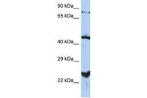 Image no. 1 for anti-MRS2 Magnesium Homeostasis Factor Homolog (MRS2) (AA 215-264) antibody (ABIN6743527) (MRS2 Antikörper  (AA 215-264))