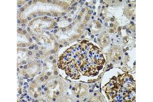 Immunohistochemistry of paraffin-embedded Rat kidney using CETP Polyclonal Antibody (CETP Antikörper)