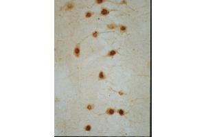 Immunohistochemistry (IHC) image for anti-Nuclear Receptor Subfamily 4, Group A, Member 2 (NR4A2) (AA 301-400) antibody (ABIN725915)