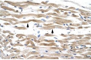 Immunohistochemical staining (Formalin-fixed paraffin-embedded sections) of human muscle with KIFC2 polyclonal antibody .