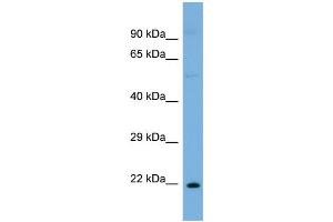 Host:  Rabbit  Target Name:  ST8SIA1  Sample Type:  OVCAR-3 Whole cell lysates  Antibody Dilution:  1. (ST8SIA1 Antikörper  (N-Term))