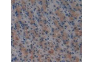 Used in DAB staining on fromalin fixed paraffin- embedded Kidney tissue (SLAMF1 Antikörper  (AA 17-227))