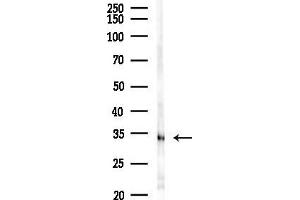 Western blot analysis of lysates from EC304 cells(UV,30 min treatment), using OR4F4 Antibody at 1/1000 dilution.
