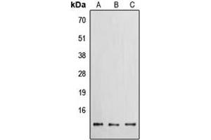 Western blot analysis of EG-VEGF expression in HEK293T (A), Raw264. (Prokineticin 1 Antikörper  (Center))
