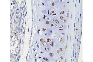 Immunohistochemistry of paraffin-embedded Rat trachea using COMP Polyclonal Antibody at dilution of 1:100 (40x lens). (COMP Antikörper)